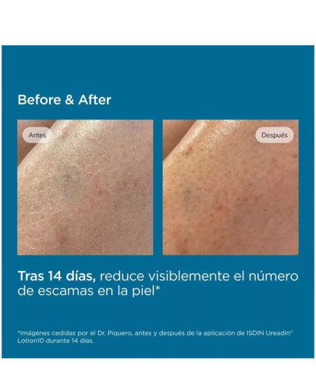 UREADIN LOTION10 HIDRATACIÓN INTENSA