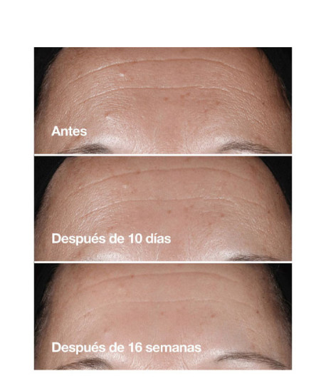 SMART CLINICAL REPAIR SERUM ESTUCHE