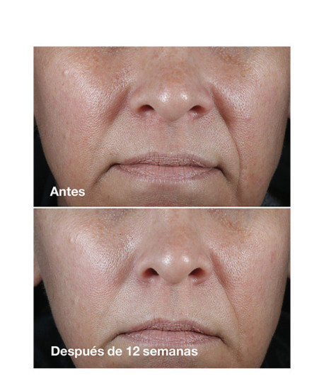 SMART CLINICAL REPAIR RICH CREAM