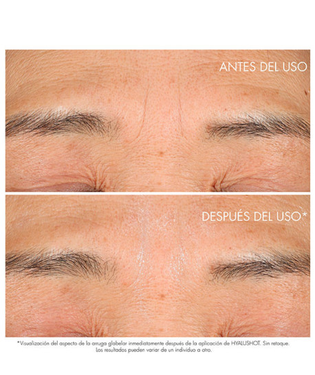 CAPTURE TOTALE HYALUSHOT