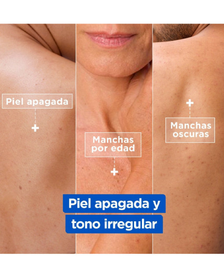 NIACINAMIDE BRIGHT CREMA HIDRATANTE ANTIMANCHAS