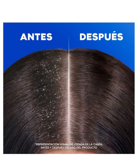 CHAMPÚ MENTHOL FRESH