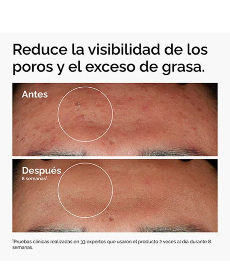 NIACINAMIDE 10% + ZINC 1%