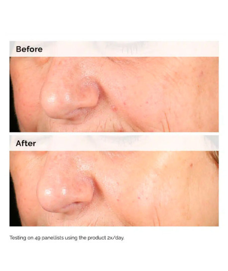 ALPHA ARBUTIN 2% + HA