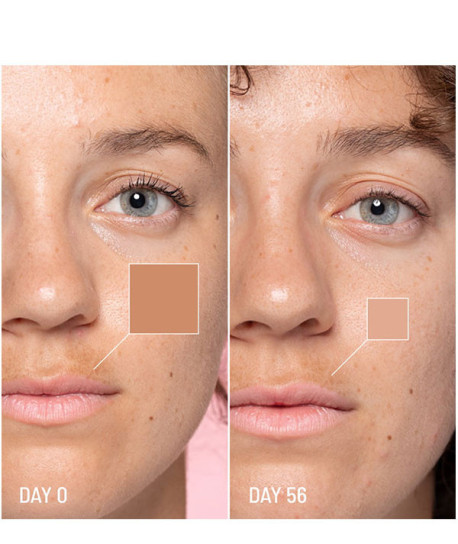 LOTUS RADIANCE DARK SPOT TREATMENT