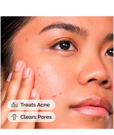 SALICYLIC ACID 2% SOLUTION