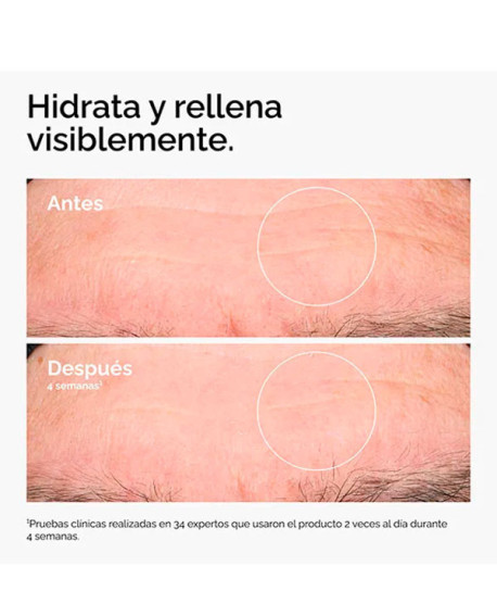 HYALURONIC ACID 2& + B5