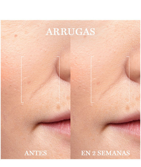 RENERGIE TRIPLE SERUM