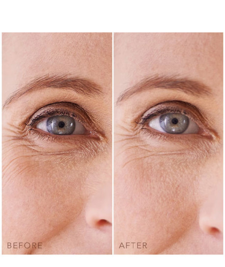 IRIS™ HYDRATING HYDROGEL EYE MASK