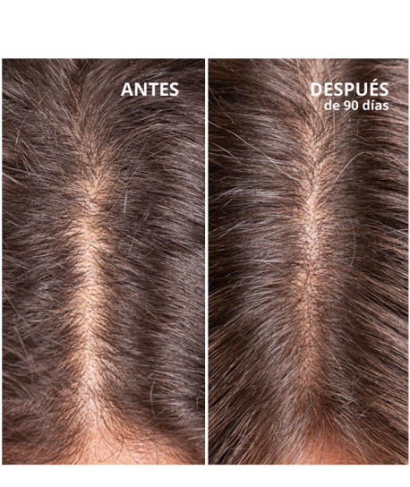 HAIR GROWTH & DENSITY TREATMENT
