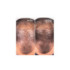 HAIR GROWTH & DENSITY TREATMENT