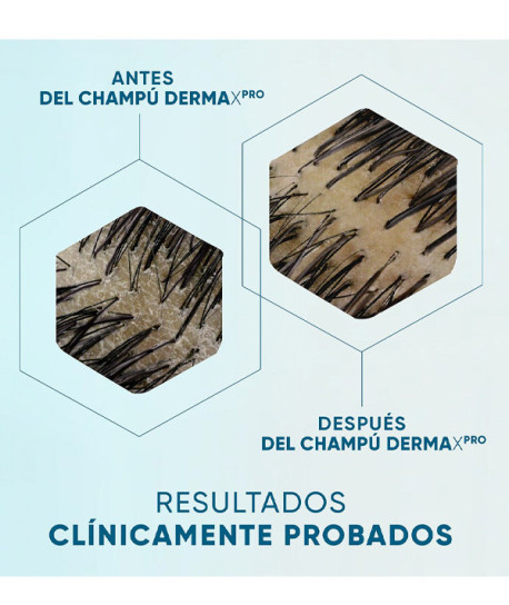 DERMAXPRO CHAMPÚ CALMANTE