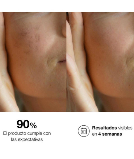 BIO10 FORTE SERUM ANTIMANCHAS