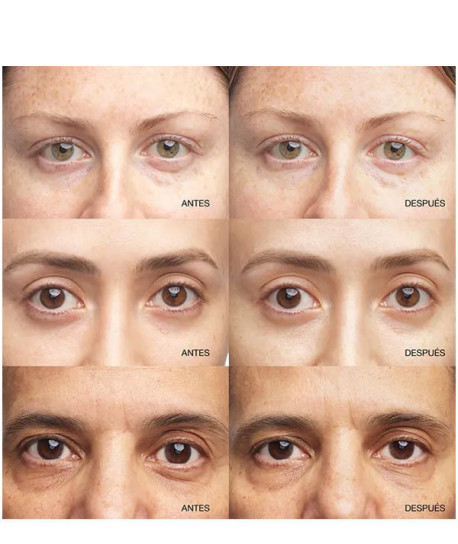 ALL ABOUT EYES BRIGHTENING SERUM CONCENTRATE