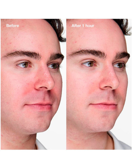 ANTI-BLEMISH SOLUTIONS CLINICAL CLEARING GEL