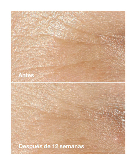 SMART CLINICAL REPAIR CREAM