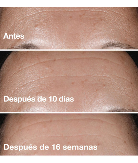 CLINIQUE SMART CLINICAL REPAIR SERUM