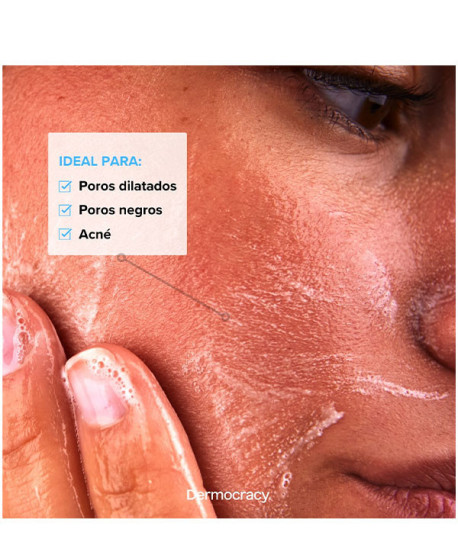 FRESH START SALICYLIC GEL CLEANSER 2%