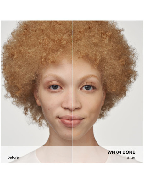 EVEN BETTER CLINICAL