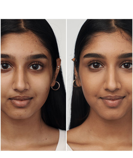 EVEN BETTER CLINICAL