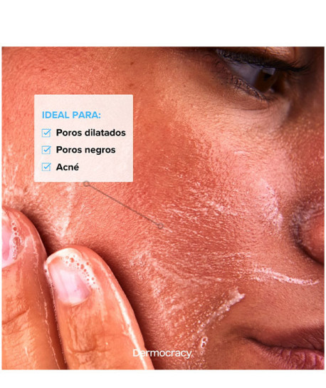 FRESH START SALICYLIC GEL CLEANSER 2%